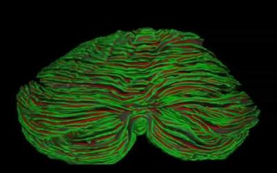 ‘Little Brain’ or Cerebellum — Not so Little After All